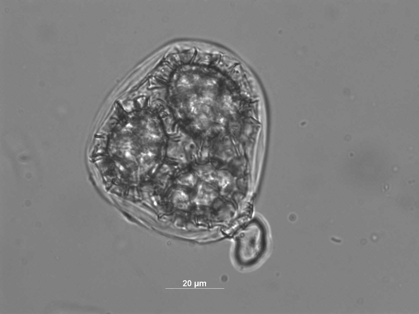 Tuber aestivum (Summer truffle) spores under the microscope